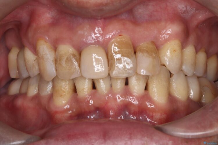 エアフロークリーニングですっきり清潔 ビフォー