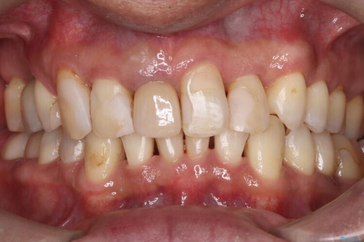 エアフロークリーニングですっきり清潔 アフター